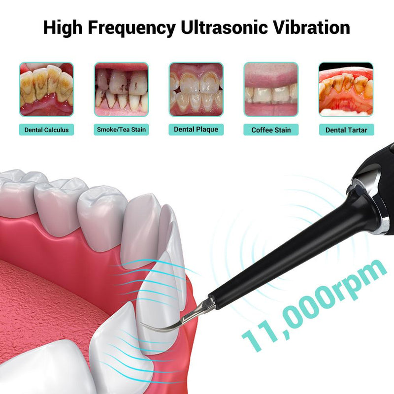 High Frequency Electric Ultrasonic Dental Tartar Plaque Calculus Tooth Remover Set Kits Cleaner with LED Screen Black